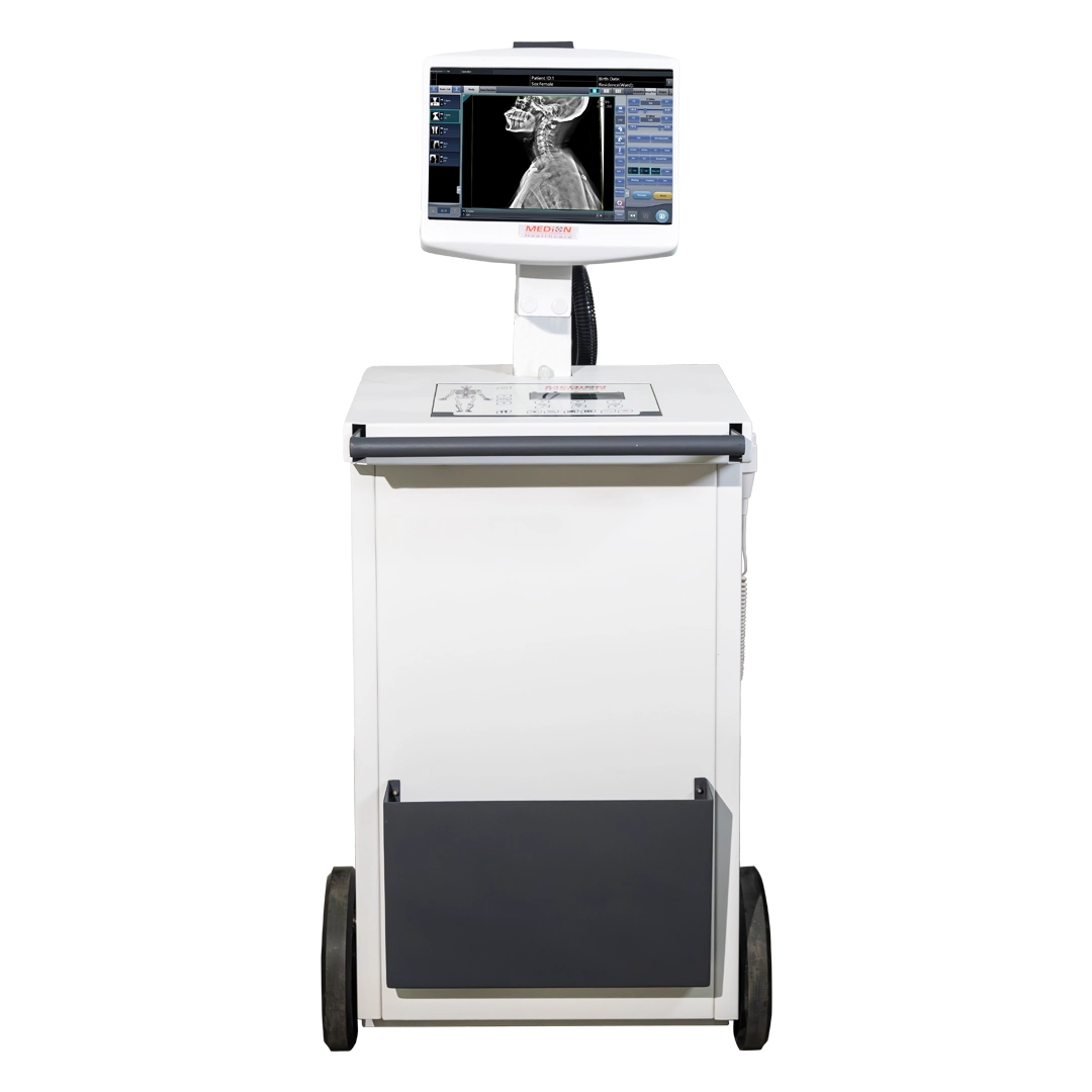MOVX mobile radiography